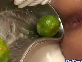 年轻的亚洲患者会对肛门柠檬恋物癖感到惊讶 japan gay porn freeze