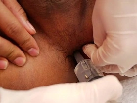 泰国twinks被角质医生检查 china slave gay porn