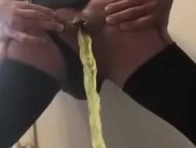 无尽型蠕虫穿透亚洲男孩的后端 gay porn japan doctor